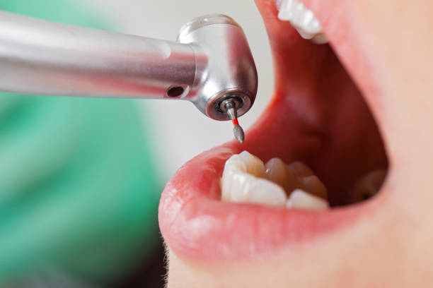 Best Orthodontic Emergency Dentist in Benton, LA